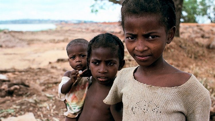 Malnutrition Surge in Madagascar