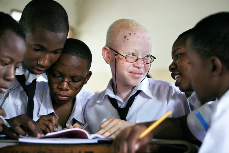 The Fight for Survival – The Plight of People with Albinism in Tanzania